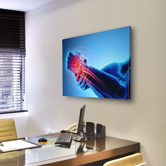 Wrist Pain X-ray Illustration Canvas Wall Art